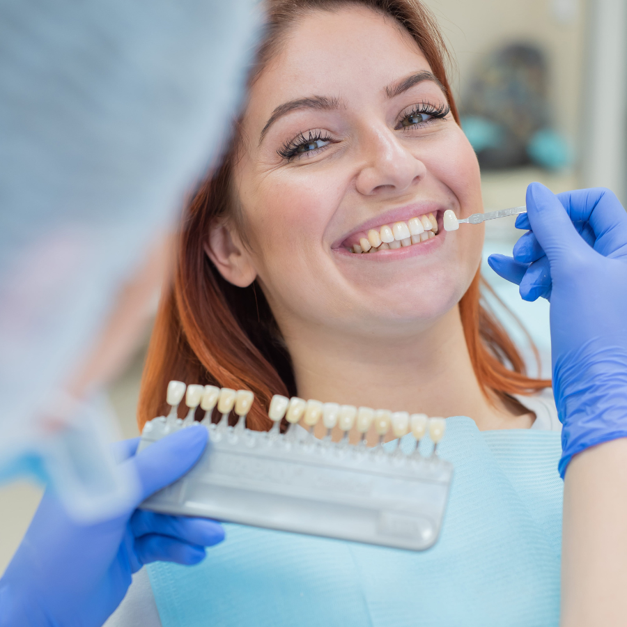 Carillas dentales en Cartagena