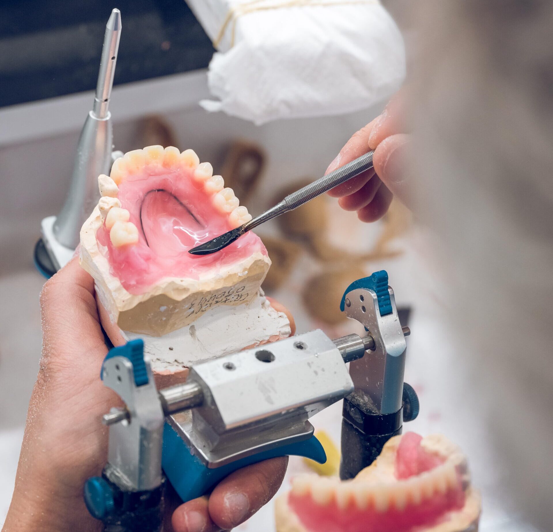 prótesis dentales en Cartagena