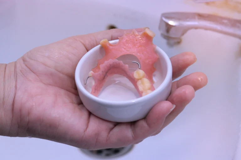 Dentadura postiza sin paladar