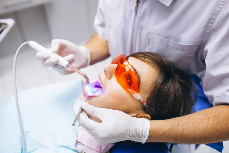 Blanqueamiento dental tras utilizar las tiras blanqueadoras de dientes